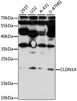 Western blot analysis of extracts of various cell lines using CLDN14 Polyclonal Antibody at 1:1000 dilution.