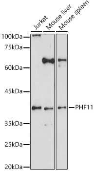 Western blot analysis of extracts of various cell lines using PHF11 Polyclonal Antibody at 1:1000 dilution.