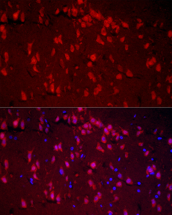 Immunofluorescence analysis of rat brain cells using RBFOX1 Polyclonal Antibody at dilution of 1:50 (40x lens). Blue: DAPI for nuclear staining.