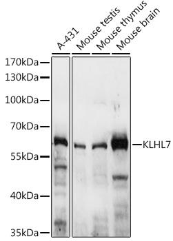 Western blot analysis of extracts of various cell lines using KLHL7 Polyclonal Antibody at 1:3000 dilution.