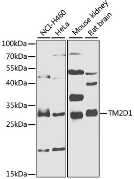 Western blot analysis of extracts of various cell lines using TM2D1 Polyclonal Antibody at 1:1000 dilution.