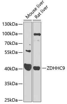 Western blot analysis of extracts of various cell lines using ZDHHC9 Polyclonal Antibody at 1:1000 dilution.