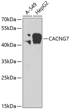 Western blot analysis of extracts of various cell lines using CACNG7 Polyclonal Antibody at 1:2000 dilution.