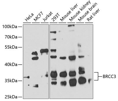 Western blot analysis of extracts of various cell lines using BRCC3 Polyclonal Antibody at 1:1000 dilution.