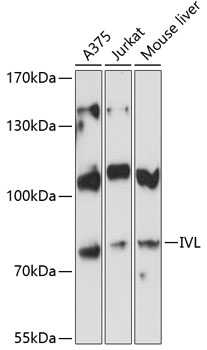 Western blot analysis of extracts of various cell lines using IVL Polyclonal Antibody at 1:3000 dilution.