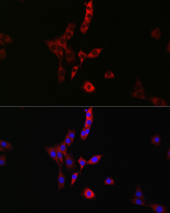 Immunofluorescence analysis of PC-12 cells using RAB35 Polyclonal Antibody at dilution of 1:100 (40x lens). Blue: DAPI for nuclear staining.