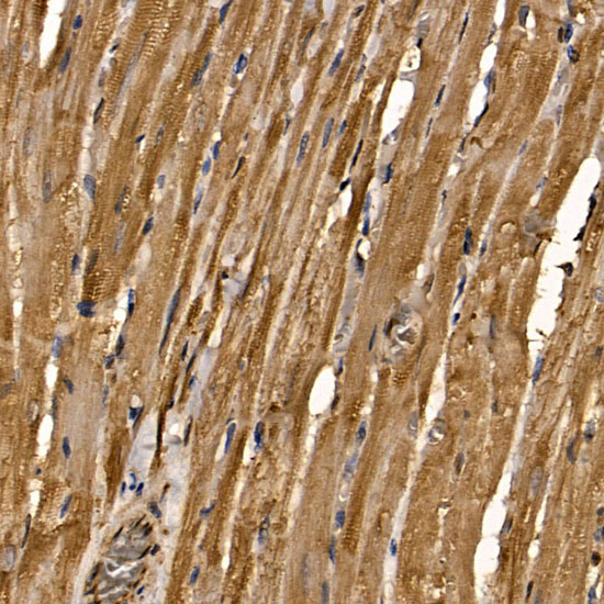 Immunohistochemistry of paraffin-embedded rat heart using RAB35 Polyclonal Antibody at dilution of 1:100 (40x lens).Perform microwave antigen retrieval with 10 mM PBS buffer pH 7.2 before commencing with IHC staining protocol.