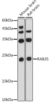 Western blot analysis of extracts of various cell lines using RAB35 Polyclonal Antibody at 1:1000 dilution.