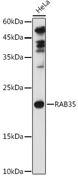 Western blot analysis of extracts of HeLa cells using RAB35 Polyclonal Antibody at 1:1000 dilution.