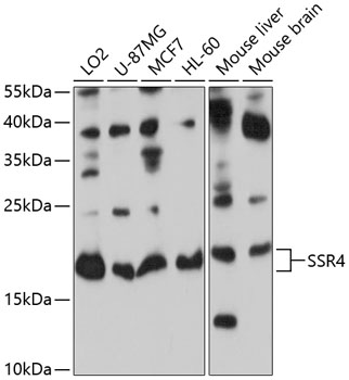 Western blot analysis of extracts of various cell lines using SSR4 Polyclonal Antibody at 1:1000 dilution.