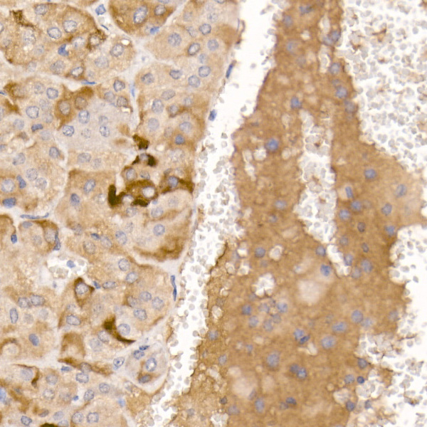 Immunohistochemistry of paraffin-embedded mouse adrenal gland using AGRP Polyclonal Antibody at dilution of 1:50 (40x lens).Perform high pressure antigen retrieval with 10 mM citrate buffer pH 6.0 before commencing with IHC staining protocol.