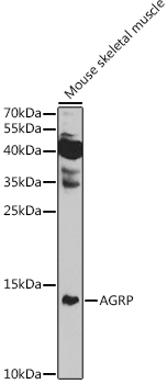 Western blot analysis of extracts of Mouse skeletal muscle using AGRP Polyclonal Antibody at 1:1000 dilution.