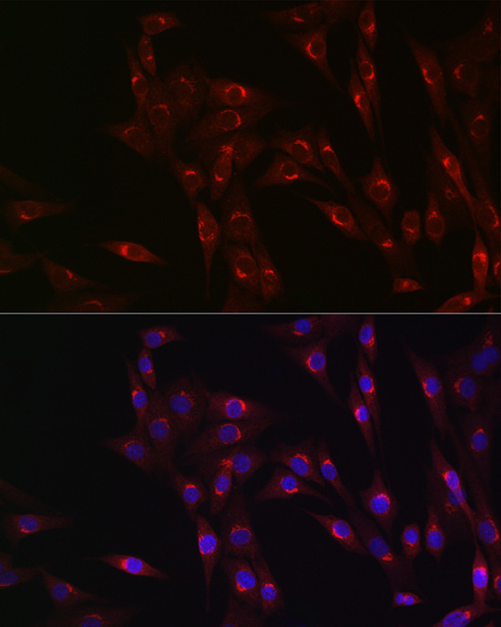 Immunofluorescence analysis of NIH/3T3 cells using MR1 Polyclonal Antibody at dilution of 1:100 (40x lens). Blue: DAPI for nuclear staining.