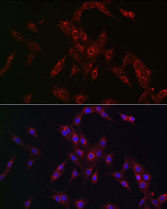 Immunofluorescence analysis of PC-12 cells using MR1 Polyclonal Antibody at dilution of 1:100 (40x lens). Blue: DAPI for nuclear staining.