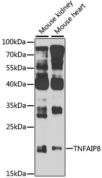 Western blot analysis of extracts of various cell lines using TNFAIP8 Polyclonal Antibody at 1:1000 dilution.