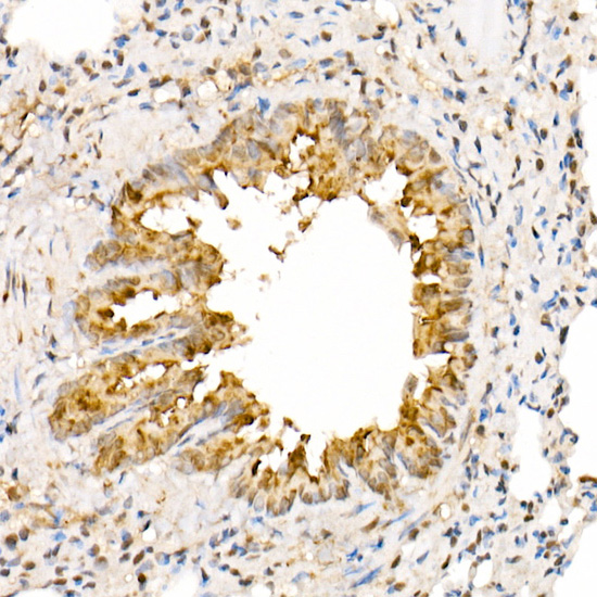 Immunohistochemistry of paraffin-embedded rat lung using ANAPC2 Polyclonal Antibody at dilution of 1:300 (40x lens).Perform high pressure antigen retrieval with 10 mM citrate buffer pH 6.0 before commencing with IHC staining protocol.