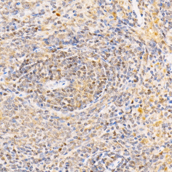 Immunohistochemistry of paraffin-embedded rat spleen using ANAPC2 Polyclonal Antibody at dilution of 1:300 (40x lens).Perform high pressure antigen retrieval with 10 mM citrate buffer pH 6.0 before commencing with IHC staining protocol.