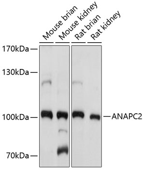 Western blot analysis of extracts of various cell lines using ANAPC2 Polyclonal Antibody at 1:1000 dilution.