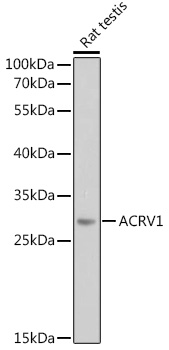 Western blot analysis of extracts of Rat testis using ACRV1 Polyclonal Antibody at 1:1000 dilution.