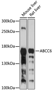 Western blot analysis of extracts of various cell lines using ABCC6 Polyclonal Antibody at 1:1000 dilution.