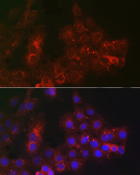 Immunofluorescence analysis of A431 cells using TROP-2 Polyclonal Antibody at dilution of 1:100 (40x lens). Blue: DAPI for nuclear staining.