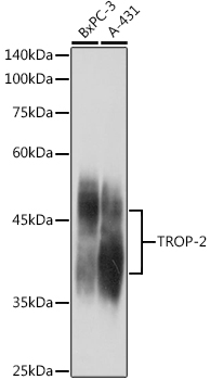 Western blot analysis of extracts of various cell lines using TROP-2 Polyclonal Antibody at 1:1000 dilution.