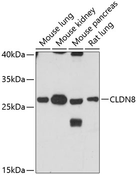 Western blot analysis of extracts of various cell lines using CLDN8 Polyclonal Antibody at 1:3000 dilution.