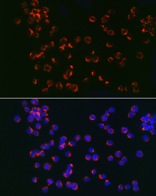 Immunofluorescence analysis of Jurkat cells using TLR6 Polyclonal Antibody at dilution of 1:100 (40x lens). Blue: DAPI for nuclear staining.