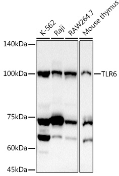 Western blot analysis of extracts of various cell lines using TLR6 Polyclonal Antibody at 1:1000 dilution.