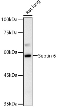 Western blot analysis of extracts of Rat lung using Septin 6 Polyclonal Antibody at 1:1000 dilution.