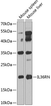 Western blot analysis of extracts of various cell lines using IL36RN Polyclonal Antibody at 1:1000 dilution.