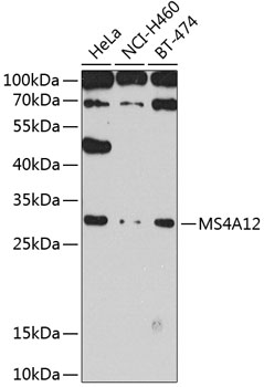 Western blot analysis of extracts of various cell lines using MS4A12 Polyclonal Antibody at 1:1000 dilution.