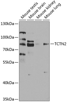 Western blot analysis of extracts of various cell lines using TCTN2 Polyclonal Antibody at 1:1000 dilution.