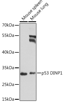 Western blot analysis of extracts of various cell lines using p53 DINP1 Polyclonal Antibody at 1:1000 dilution.