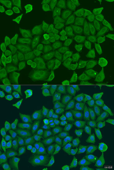 Immunofluorescence analysis of U2OS cells using SHC4 Polyclonal Antibody at dilution of 1:100. Blue: DAPI for nuclear staining.