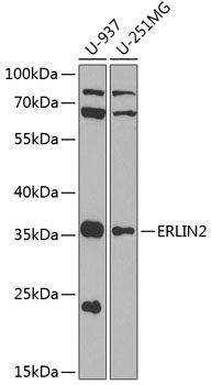 Western blot analysis of extracts of various cell lines using ERLIN2 Polyclonal Antibody at 1:1000 dilution.