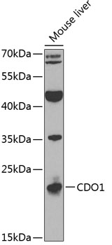 Western blot analysis of extracts of mouse liver using CDO1 Polyclonal Antibody at 1:1000 dilution.