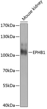 Western blot analysis of extracts of mouse kidney using EPHB1 Polyclonal Antibody at 1:1000 dilution.