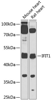 Western blot analysis of extracts of various cell lines using IFIT1 Polyclonal Antibody at 1:1000 dilution.