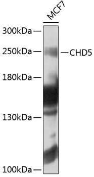 Western blot analysis of extracts of MCF-7 cells using CHD5 Polyclonal Antibody at 1:1000 dilution.