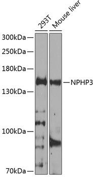 Western blot analysis of extracts of various cell lines using NPHP3 Polyclonal Antibody at 1:1000 dilution.