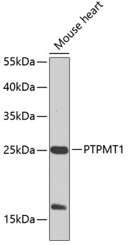 Western blot analysis of extracts of mouse heart using PTPMT1 Polyclonal Antibody at 1:1000 dilution.