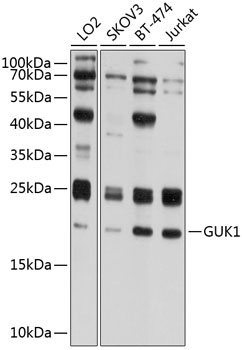 Western blot analysis of extracts of various cell lines using GUK1 Polyclonal Antibody at 1:1000 dilution.