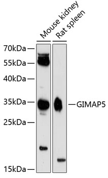 Western blot analysis of extracts of various cell lines using GIMAP5 Polyclonal Antibody at 1:3000 dilution.