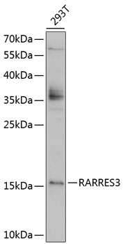 Western blot analysis of extracts of 293T cells using RARRES3 Polyclonal Antibody at 1:1000 dilution.