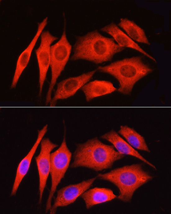 Immunofluorescence analysis of NIH/3T3 cells using PAR2 Polyclonal Antibody at dilution of 1:100 (40x lens). Blue: DAPI for nuclear staining.