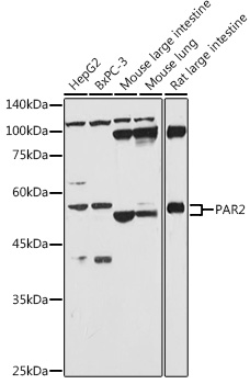 Western blot analysis of extracts of various cell lines using PAR2 Polyclonal Antibody at 1:1000 dilution.