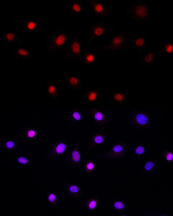 Immunofluorescence analysis of NIH/3T3 cells using LEO1 Polyclonal Antibody at dilution of 1:50 (40x lens). Blue: DAPI for nuclear staining.