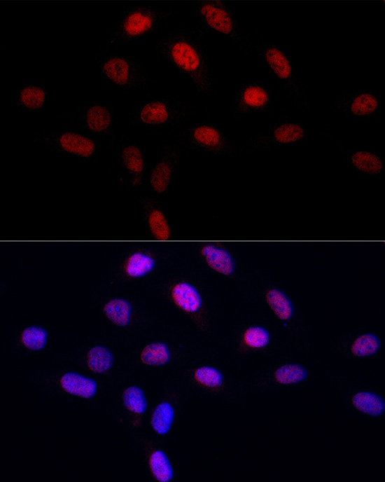 Immunofluorescence analysis of U2OS cells using LEO1 Polyclonal Antibody at dilution of 1:50 (40x lens). Blue: DAPI for nuclear staining.