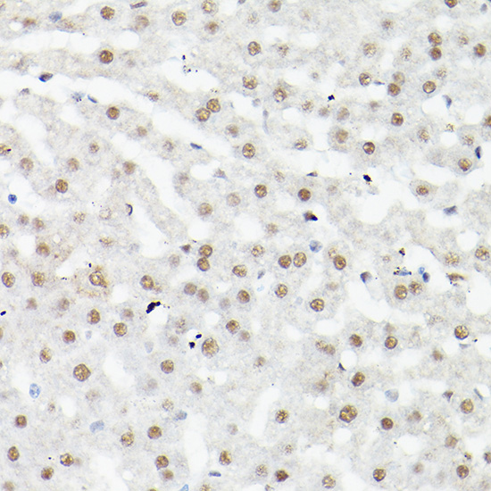 Immunohistochemistry of paraffin-embedded mouse liver using LEO1 Polyclonal Antibody at dilution of 1:100 (40x lens).Perform high pressure antigen retrieval with 10 mM citrate buffer pH 6.0 before commencing with IHC staining protocol.